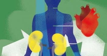 Eerste succesvolle transplantatie van donor met hiv